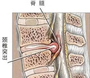 头倒立有很多好处,但有些人不能做头倒立2